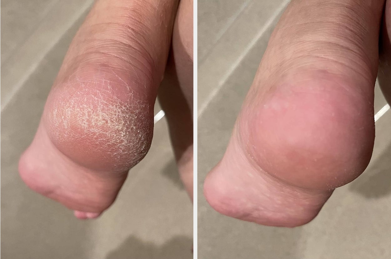 30 Products With Before-And-After Photos That’ll Inspire You To Get Your Life Together