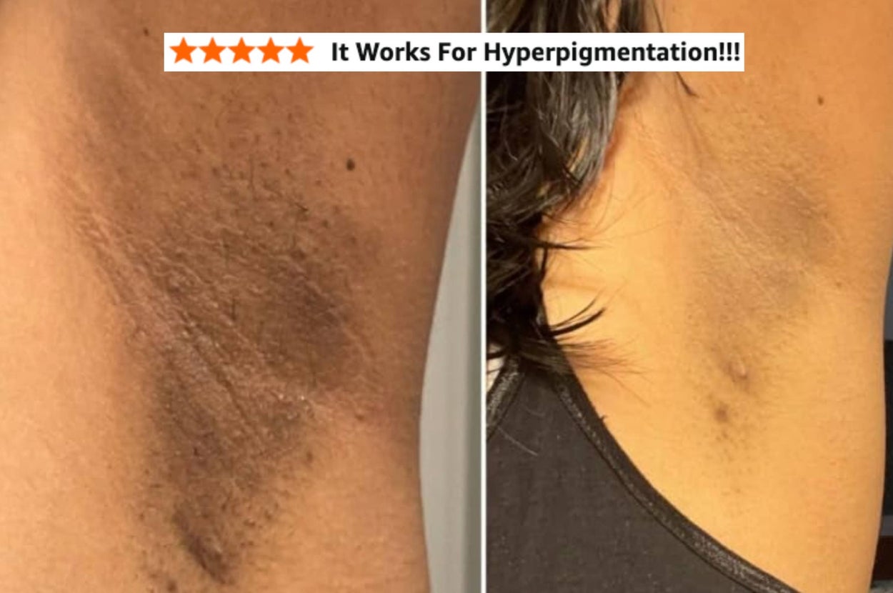 We All Have ~Uncomfortable~ Issues, And These 34 Products Can Actually Help Solve Them