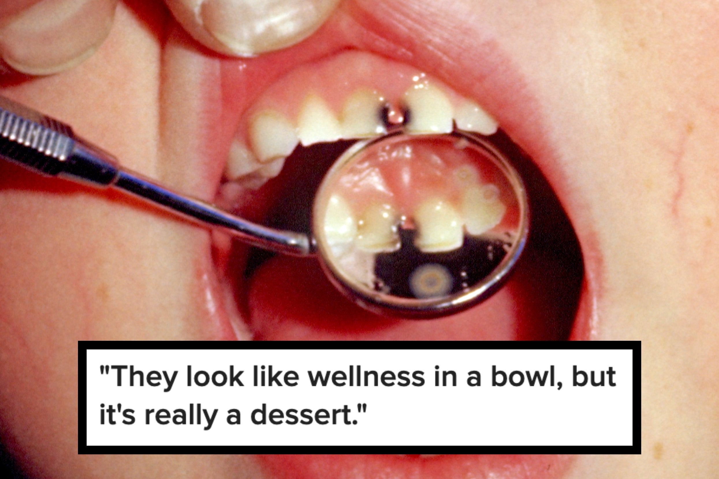 Health Experts Are Begging People To Stop Falling For These 23 “Healthy” Foods That Are Secretly Ruining Your Health