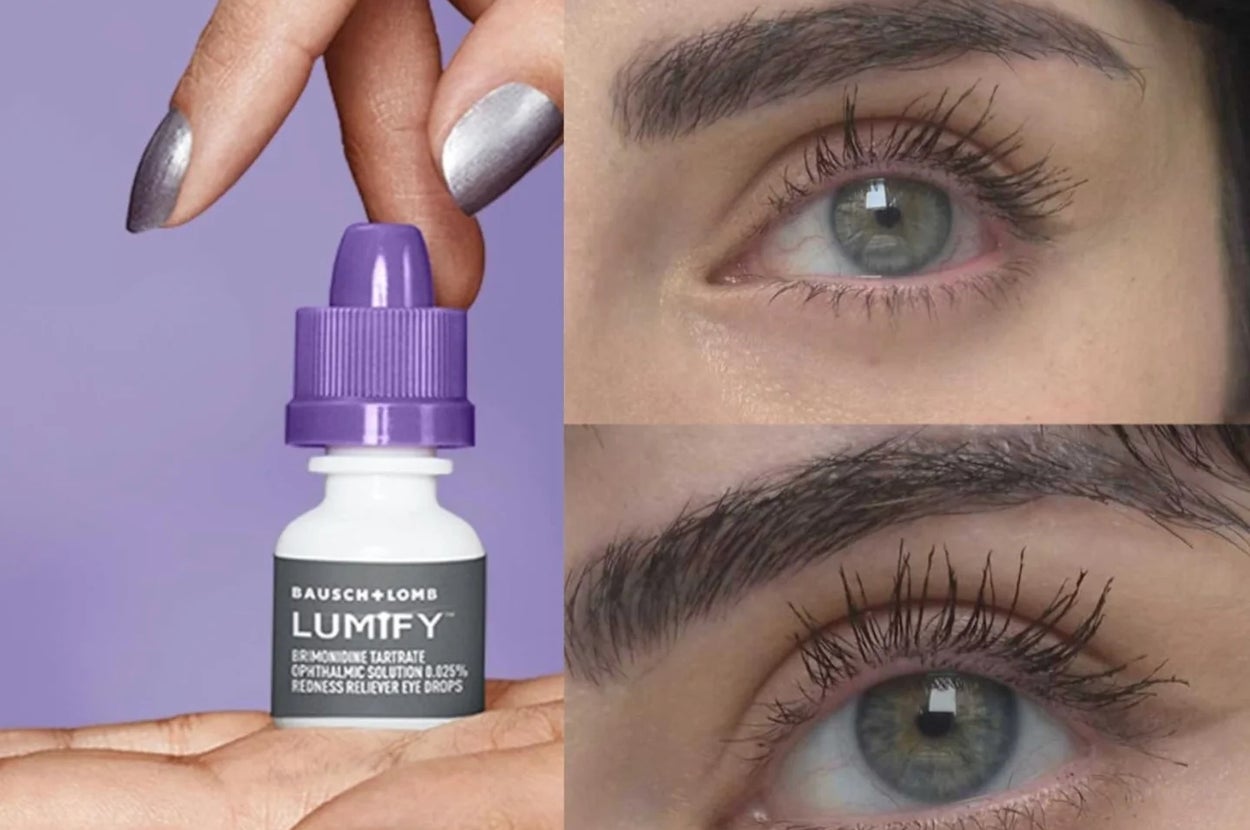 This Lo-Fi Product Is Like Magic For My Irritated Eyes, And Eye Doctors Explained Why