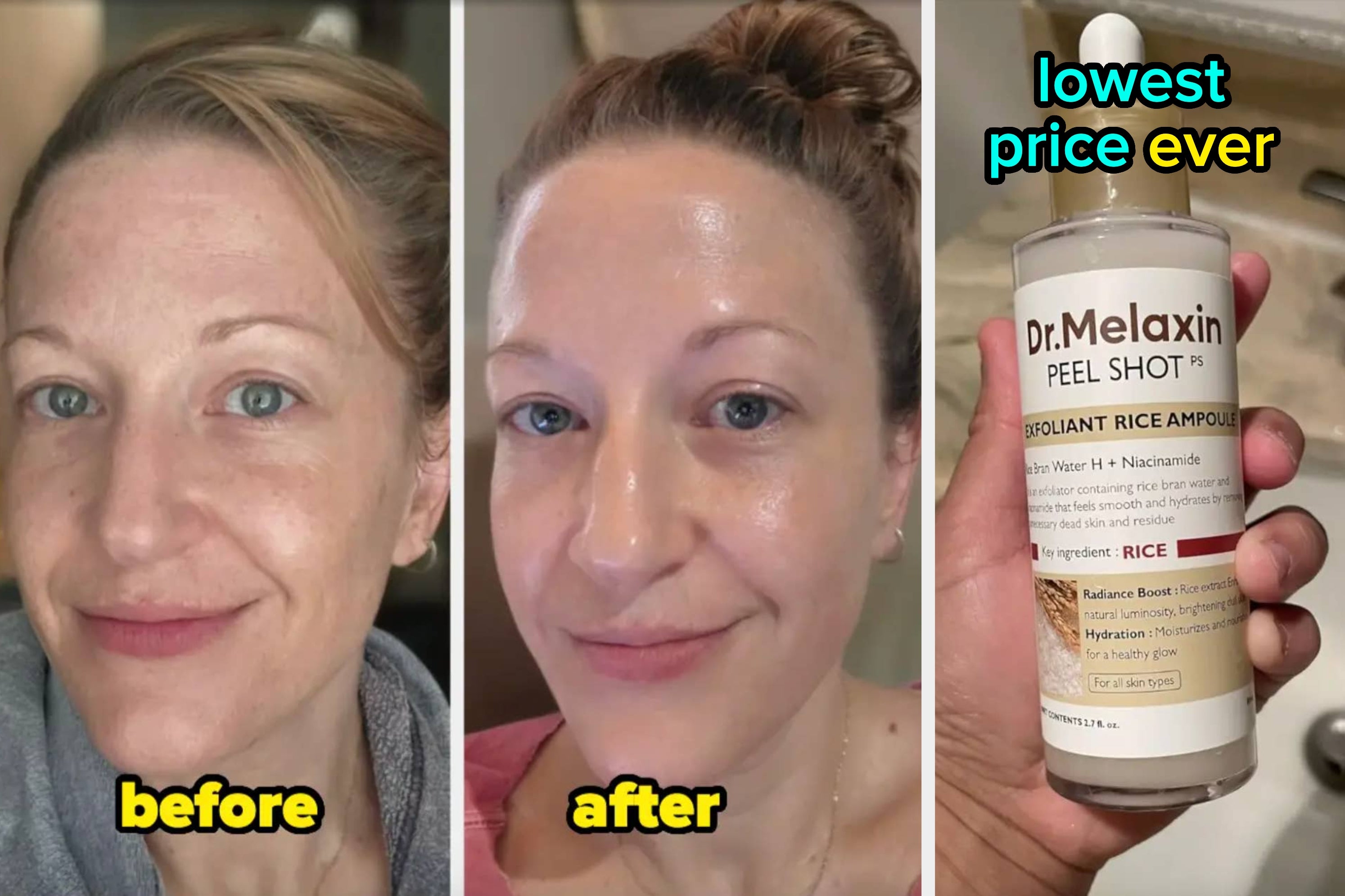 46 Prime Day Deals On Products With Result Photos That Are Downright Shocking