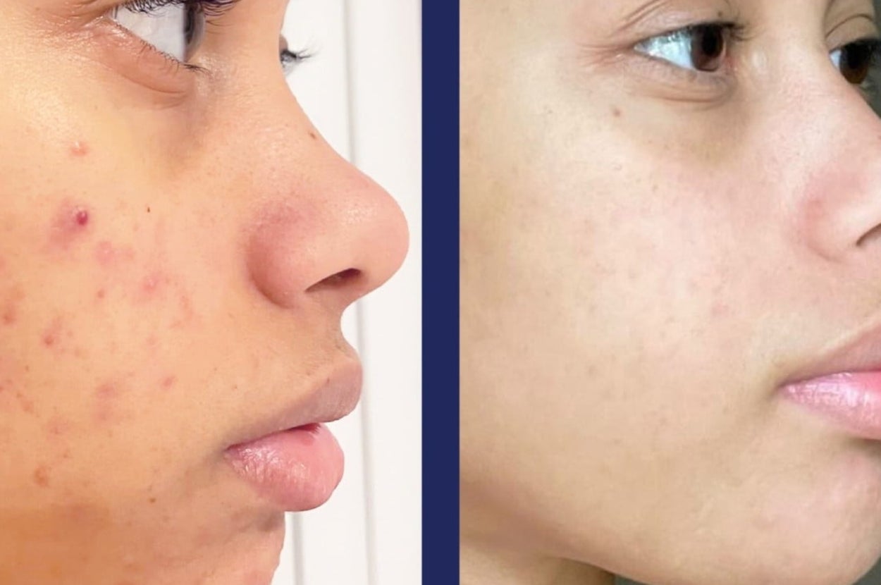 27 Walmart Skincare Products That Deserve A Permanent Place In Your Cabinet