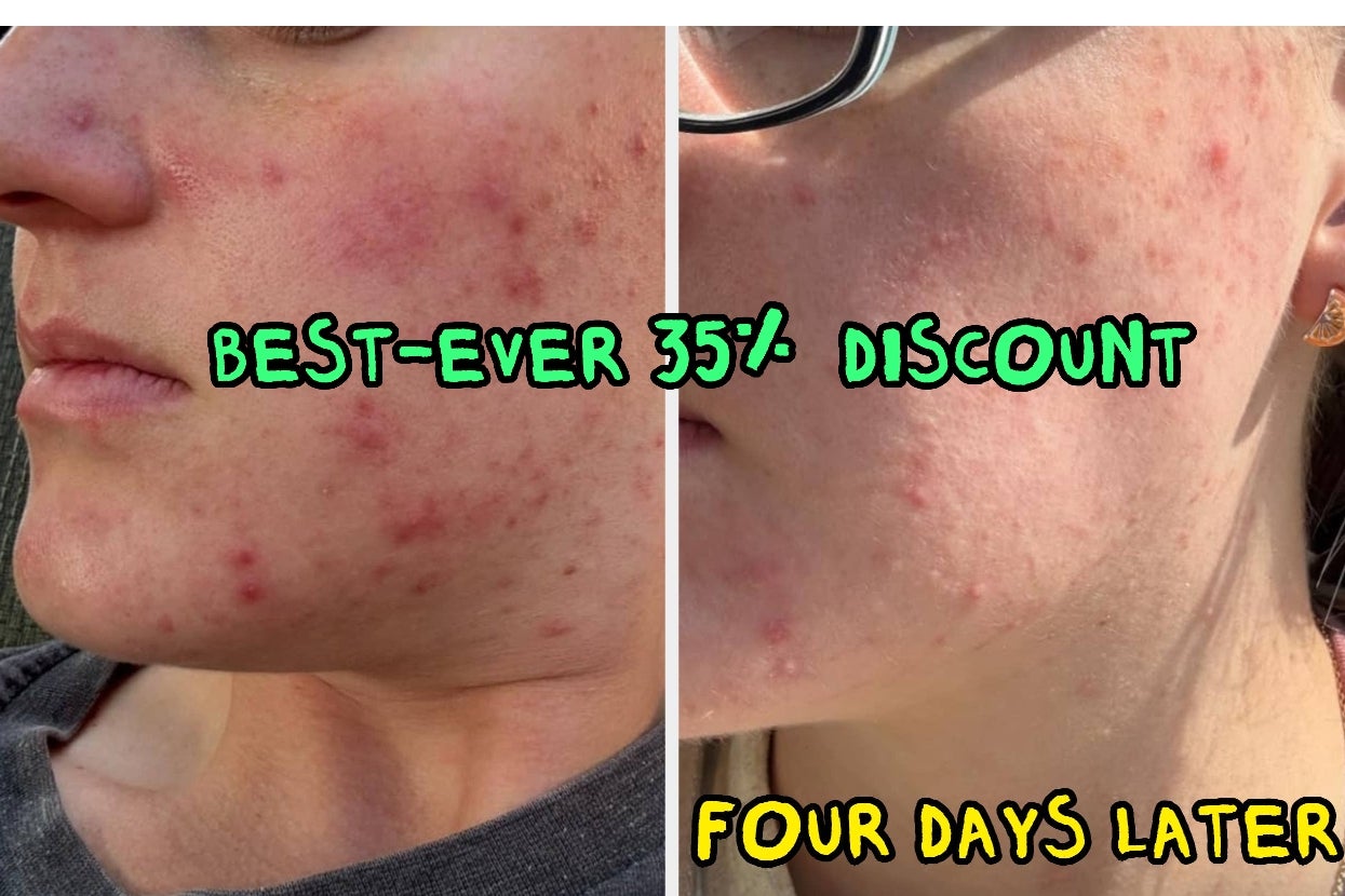 These 26 Things Are At Their Lowest-Ever Prices This Fall Prime Day, So, You Know, You Might Want To Get Them Now