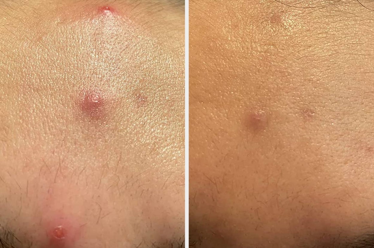 If You’re Looking For Super-Effective Skincare Products Without Spending The Big Bucks, This Post Is For You